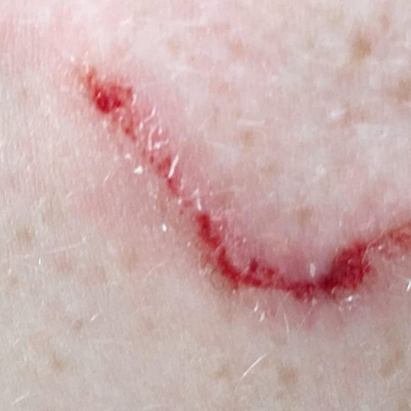 Bio Oil - Picture 3 of 10